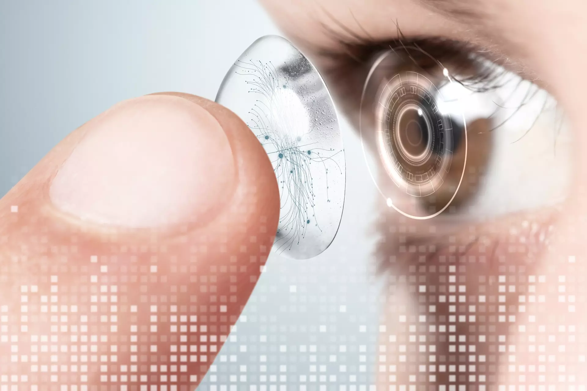 Cost of LASIK vs. Contact Lenses